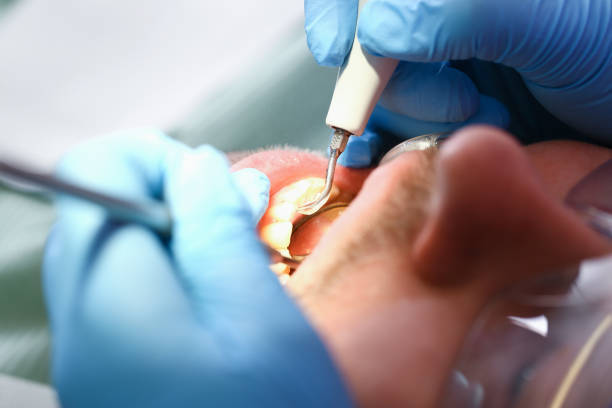 Best Knocked-Out Tooth Emergency  in Hopewell, NJ