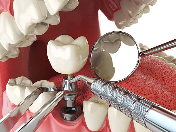 Best Broken Tooth Emergency  in Hopewell, NJ